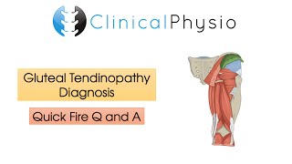 Classic Gluteal Tendinopathy Diagnosis  Clinical Physio [upl. by Ginsburg114]