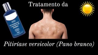 Tratamento da Pitiríase versicolor Pano branco [upl. by Elaina]