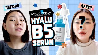 Honest Review 14 days WITH LA ROCHEPOSAY Hyalu B5 Hyaluronic Acid Serum [upl. by Quarta]