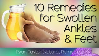 10 Home Remedies for Swollen Feet and Ankles [upl. by Laresa]