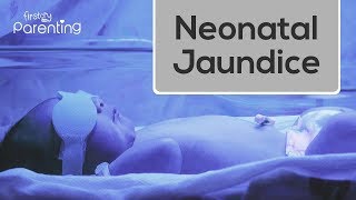 Neonatal Jaundice  Causes Symptoms and Treatment [upl. by Claudetta69]