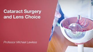 Cataract Surgery and Lens Choice [upl. by Acimaj698]