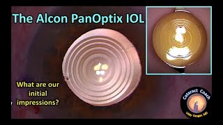 Review of the Alcon PanOptix lens for Cataract Surgery [upl. by Niarbo]