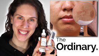 THE ORDINARY  3 BEST DARK SPOTS amp PIGMENTATION PRODUCTS [upl. by Martinez]