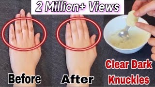 Do This Every Night For 7 Days To Lighten Dark Knuckles And Brighten Hands amp Feet  Faiqa Studio [upl. by Sola932]