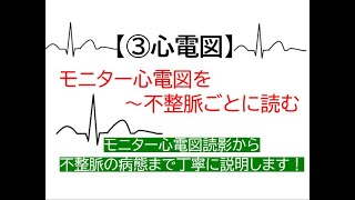 ③心電図～モニター心電図を不整脈ごとに読む循環器医が不整脈の病態から1つ1つ解説します [upl. by Anrym]