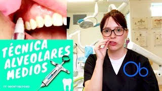 Técnica Alveolares Medios 💉 [upl. by Tengler]