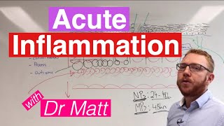 Acute Inflammation  Immunology [upl. by Keisling]