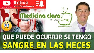 Sangre en las heces sangre con la deposición Enfermedades asociadas  Medicina Clara [upl. by Aikym]