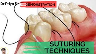 SUTURING TECHNIQUESDEMONSTRATION [upl. by Ingamar]