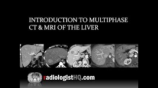 Liver Cirrhosis  Causes Symptoms Complications Diagnosis amp Treatment  Dr Govind Verma [upl. by Reuben]